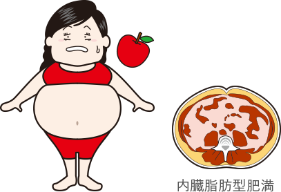 内臓脂肪型肥満